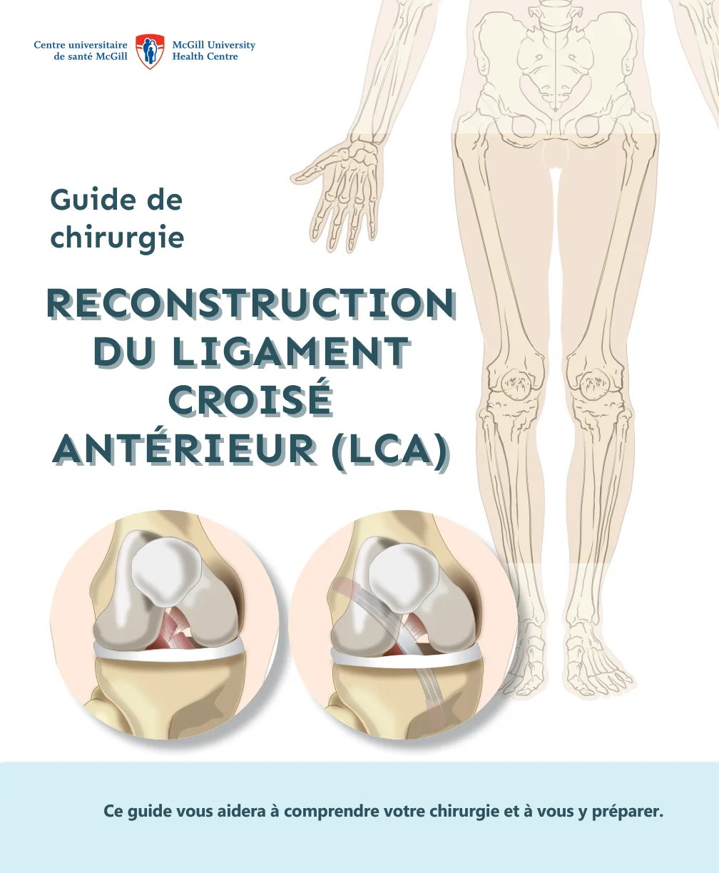 Guide de chirurgie Reconstruction Du Ligament Croisé Antérieur (LCA)