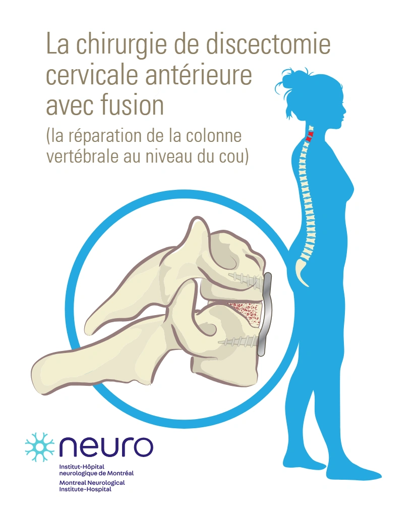 Anterior cervical discectomy and fusion surgery