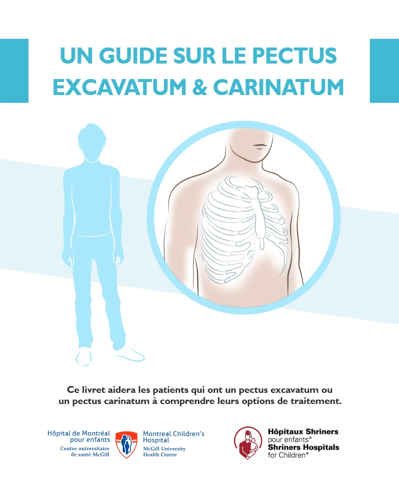A guide to pectus excavatum & carinatum